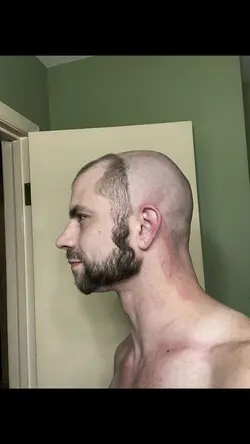 Add 10 clips