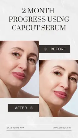 White Minimalist Before and After Skincare Instagram Story