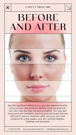 Before and After Skin Care Effect Display