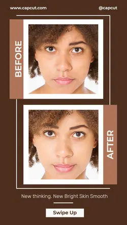 Beauty Before and after comparison Instastory