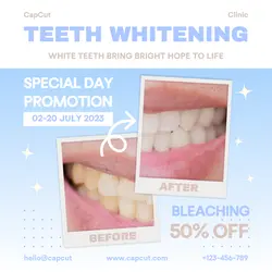 Before After Teeth Promotion Instagram Post