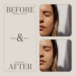 Skin Care Before and After Comparison