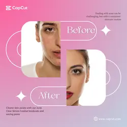 Skincare Before After Instagram Post Gradient Pink