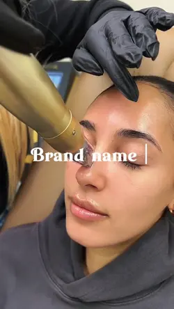 Microneedling aesthe