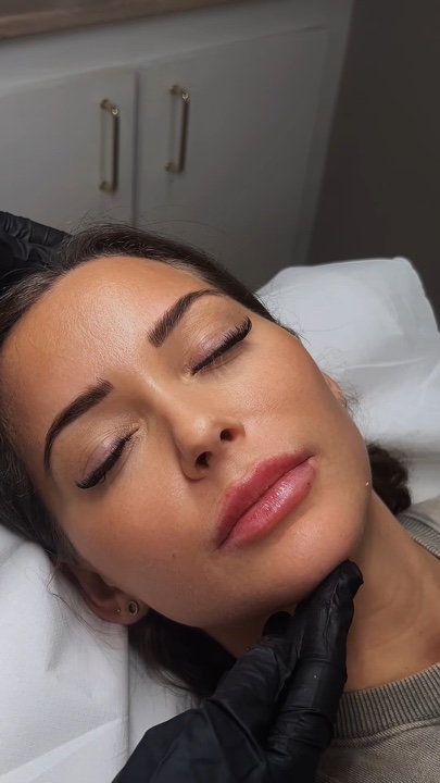 Lip filler
