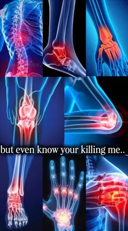 killing me