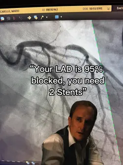 LAD 95% blocked 