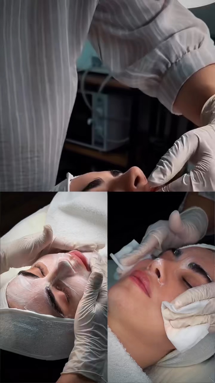 Facial