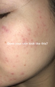 Skincare 