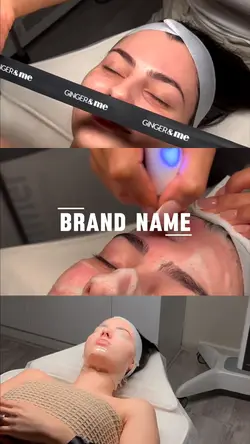 Microneedling