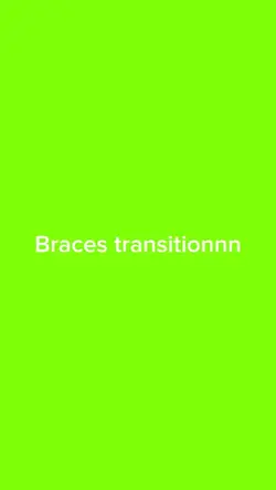 BRACES TRANSITIONNNN