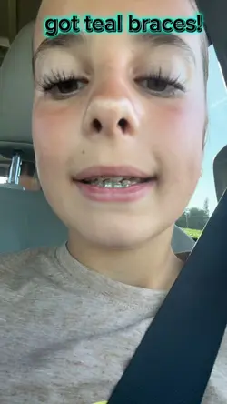 teal braces!