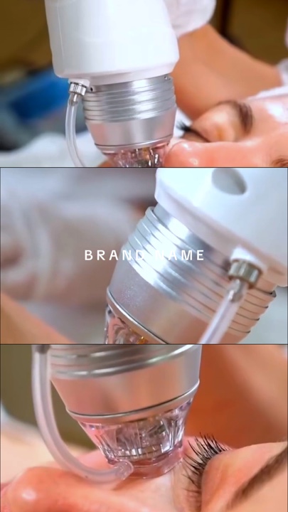 Microneedling esthétique