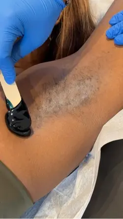 Underarm