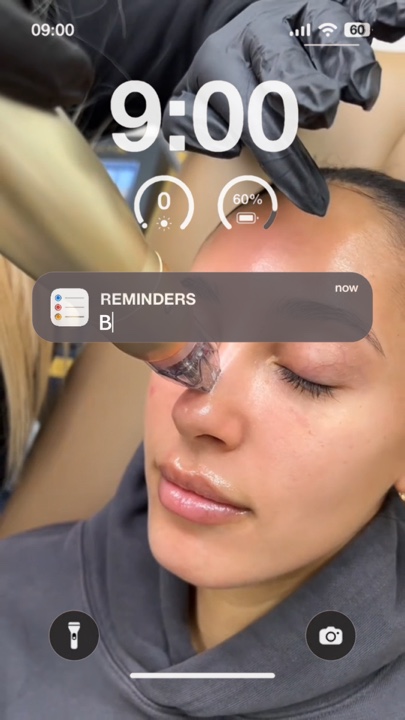 Microneedling aesthe