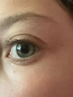 Eye transition