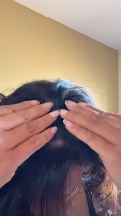 Hair thinning TikTok