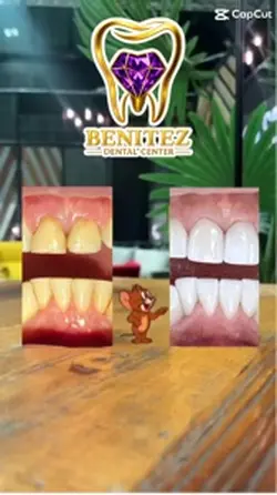 Before /After
