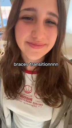 braces transitionnnn