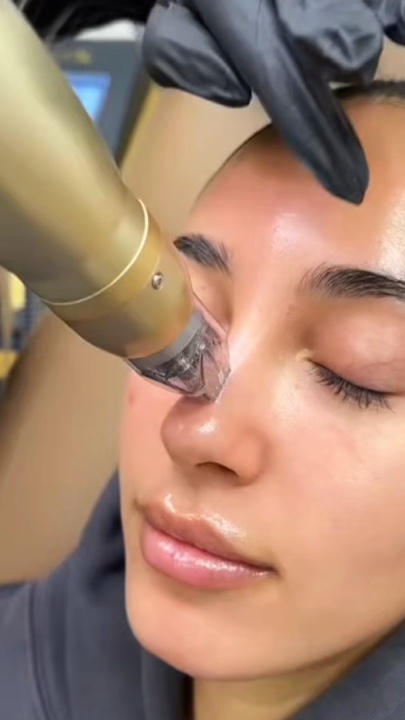 Microagujas