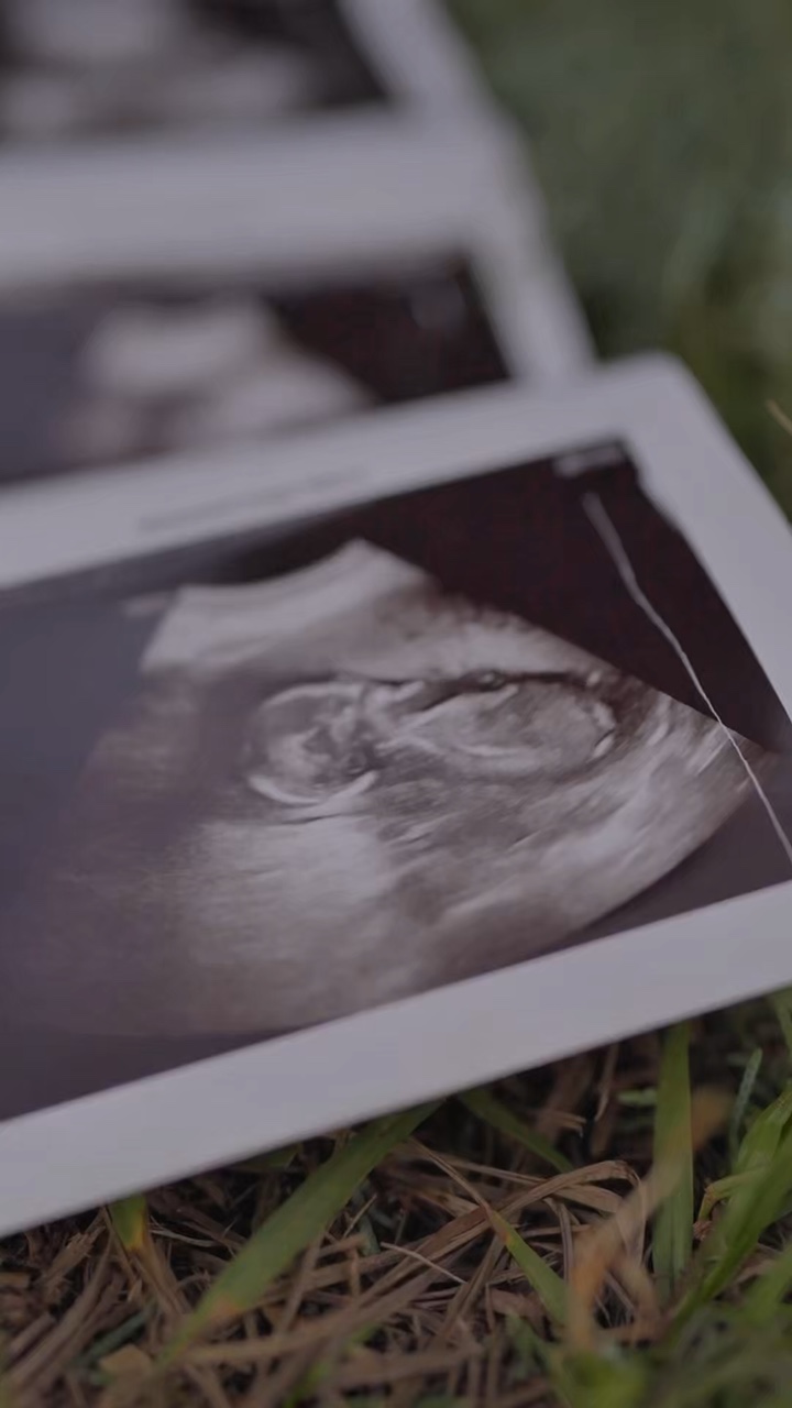 pregnancy announceme