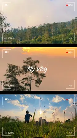 Transisi estetik bgt