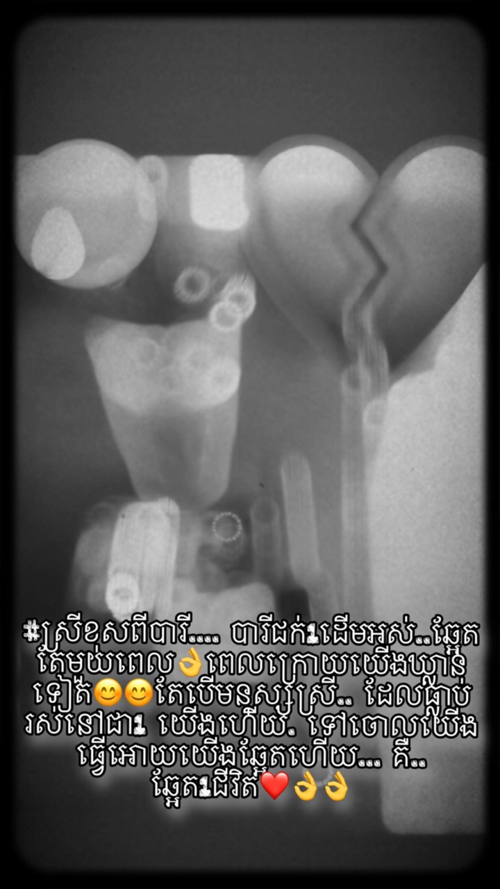 មនុស្ស្ស្រីខុសពីបារី😢