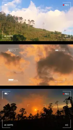 Transisi estetik bgt