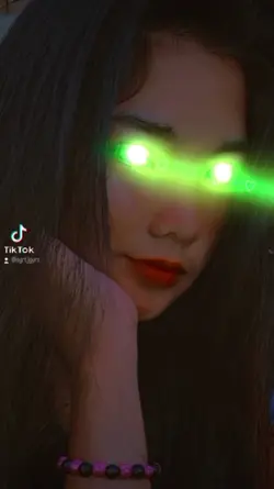 trendy eye laser