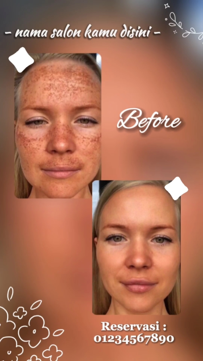 facial before after