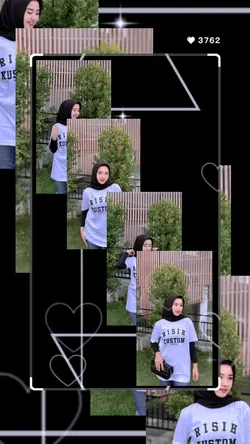 Transisi Estetik yah