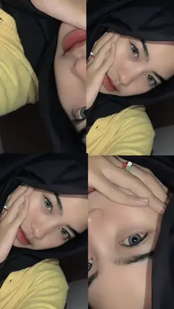 aesthetic bgt