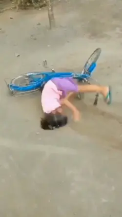 cú ngã gẫy răng