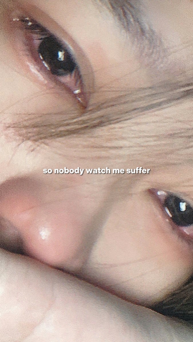 nobody watch suffer
