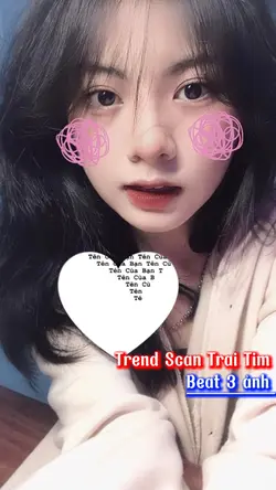 Trend Scan Trái Tim 