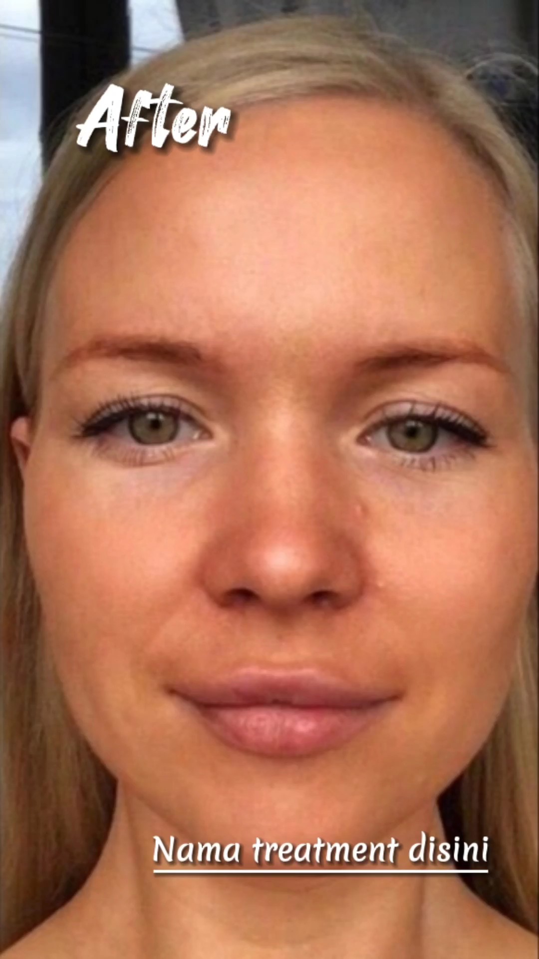 Facial antes y después