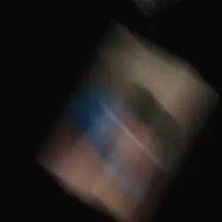 เลเซอร์