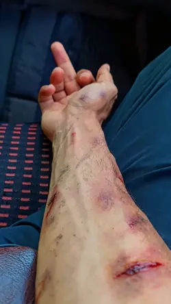 AI WOUNDS