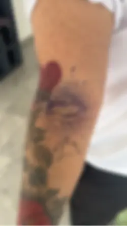 Tattoo eye
