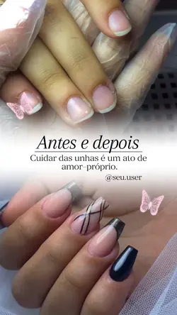 Antes e depois unhas