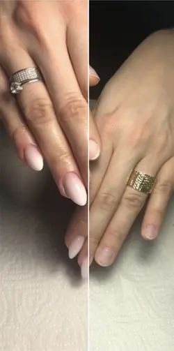 Antes e depois