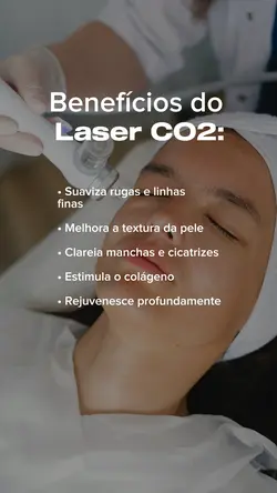 Laser co2 - estética