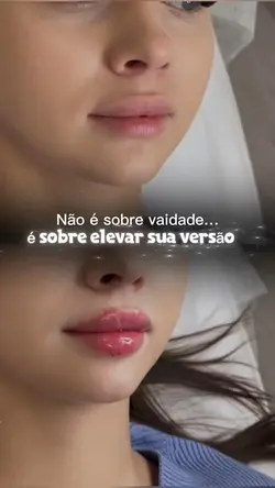 Preenchimento labial