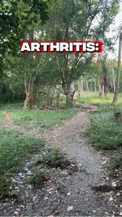Arthritis: iwasan to