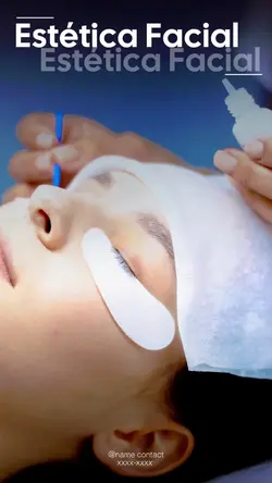 ESTÉTICA FACIAL 