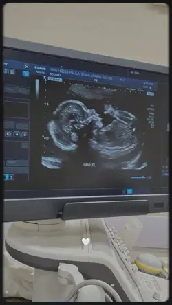 gestação ultrassom 