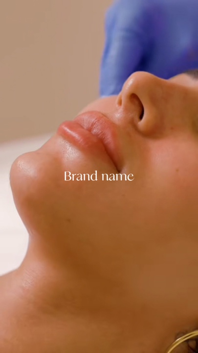 Microneedling
