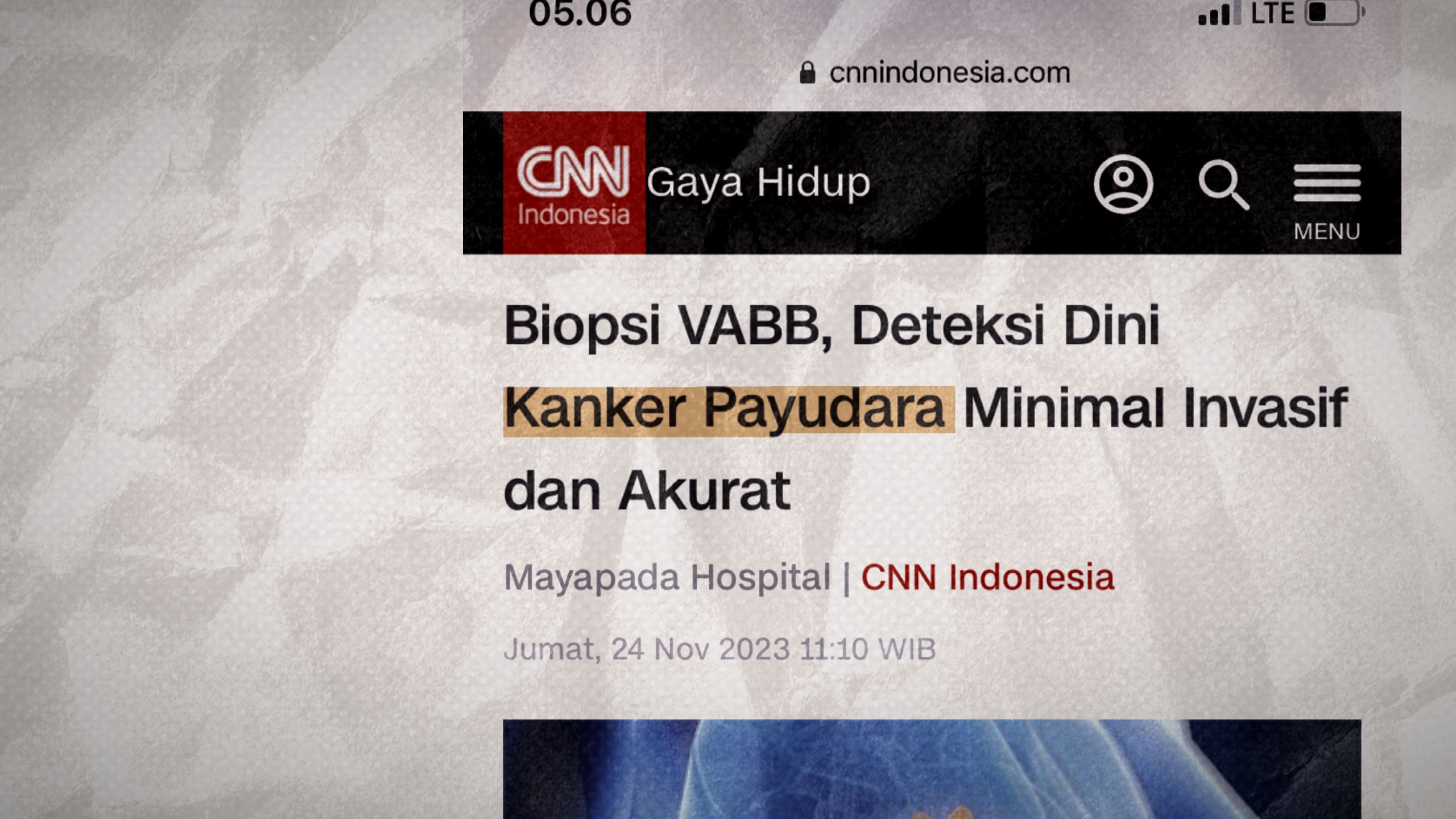 Cover Picture