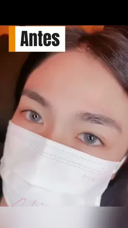 Antes y después
