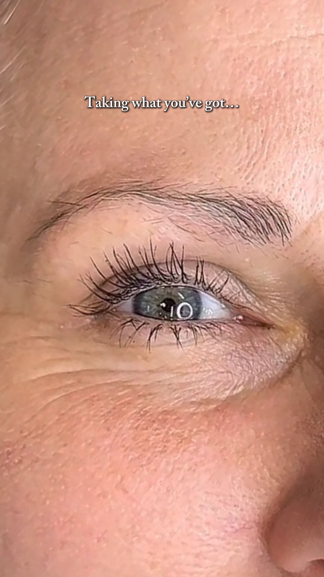 Brow Transformatio